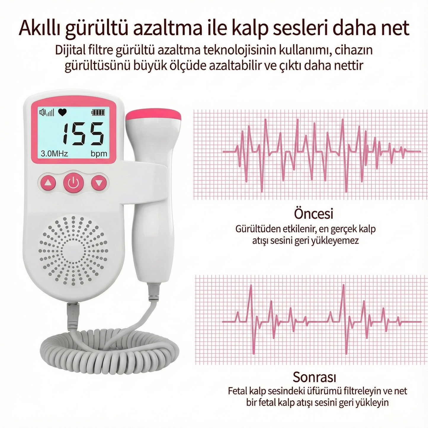 BabyHertz™ Ultrasonik Fetal Doppler