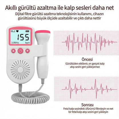 BabyHertz™ Ultrasonik Fetal Doppler